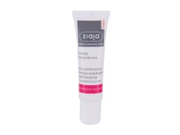 Ziaja Med Capillary Treatment Concentrated Emulsion Krem do twarzy na dzień Bez ochrony SPF 30 ml (W) (P2)